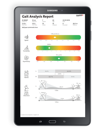 GaitUp analysis report image